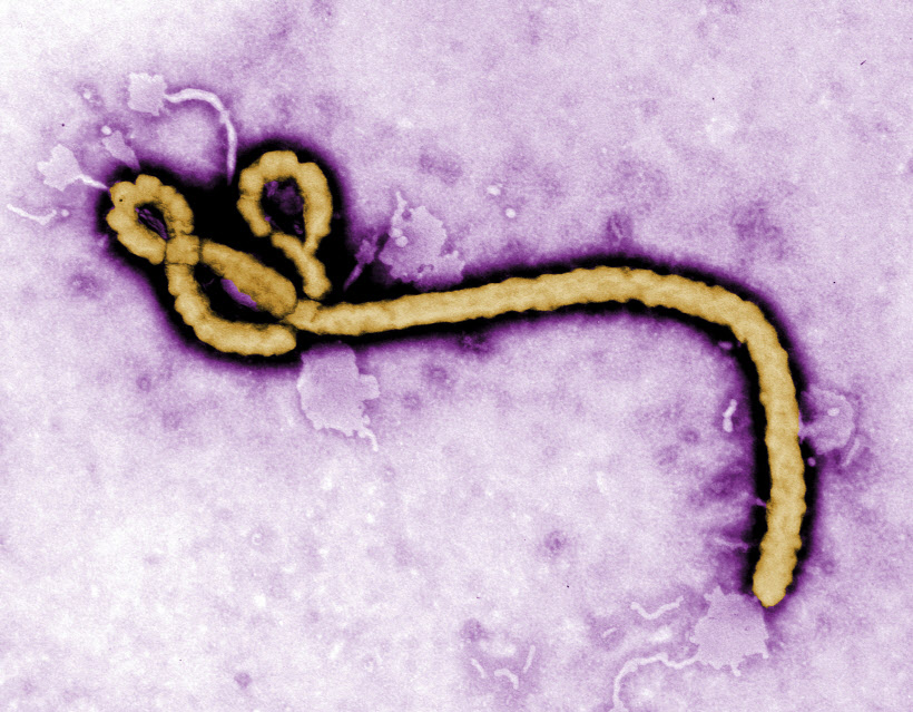 민주콩고 에볼라 바이러스 대도시로 확산